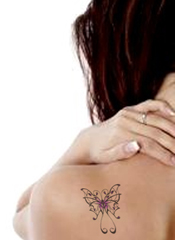 laser tattoo removal 